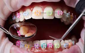 Colorado Orthodontics