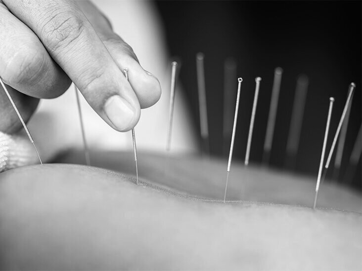 Caldwell Chiropractic and Acupuncture