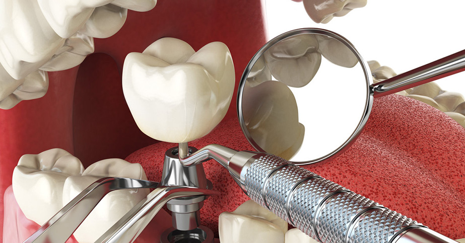 Dental Delhi